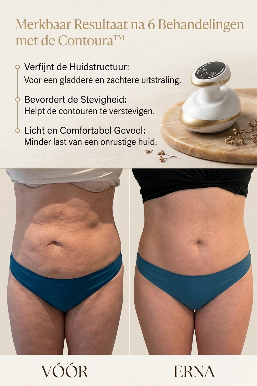 Contoura™ Anti-Cellulite Tool voor een Zelfverzekerde Zomerhuid