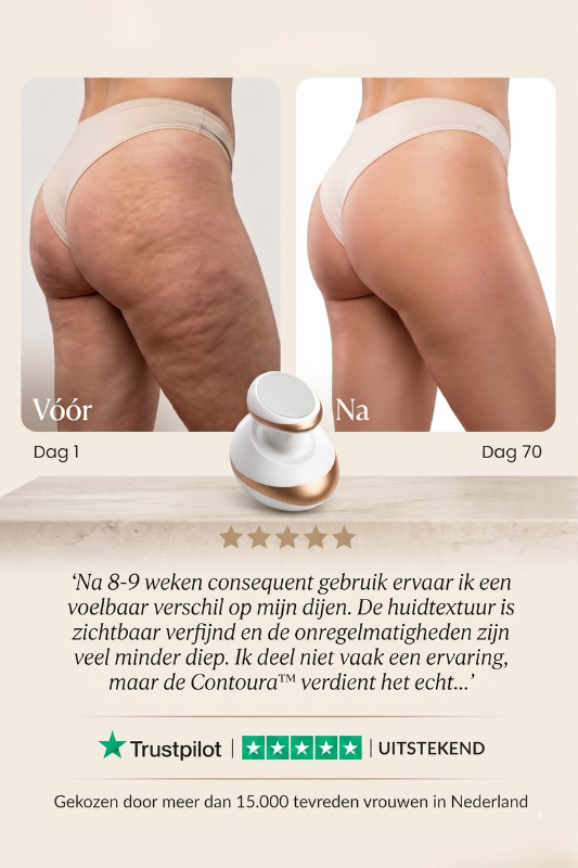 Contoura™ Anti-Cellulite Tool voor een Zelfverzekerde Zomerhuid